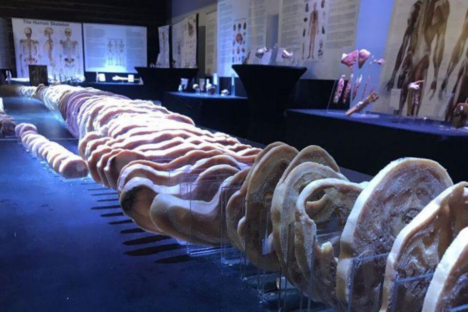 In Scheiben präparierter menschlicher Körper in der Ausstellung „Echte menschliche Körper“, ergänzt durch anatomische Schautafeln und einzelne Präparate. | © koerper-ausstellung.de